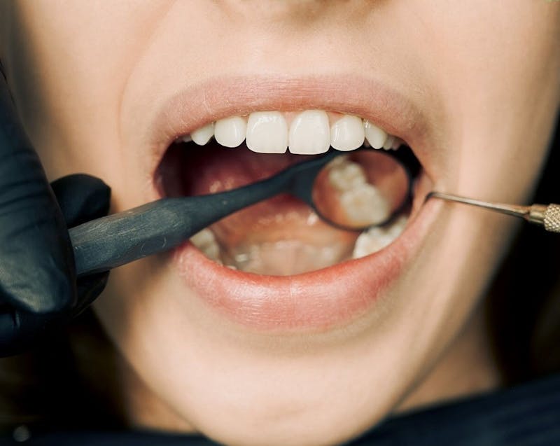 teeth checkup