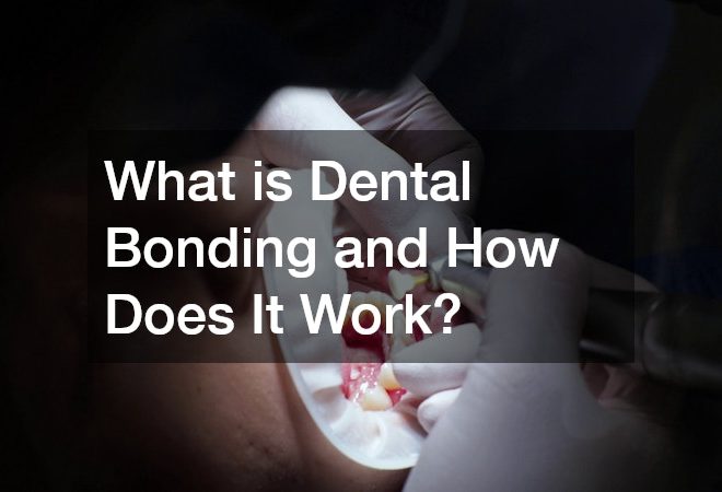 What is Dental Bonding and How Does It Work?