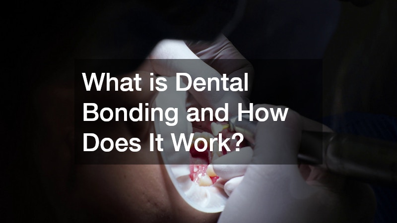 What is Dental Bonding and How Does It Work?