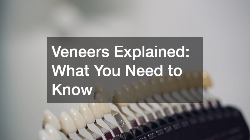 Veneers Explained What You Need to Know