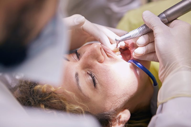 From Diagnosis to Aftercare: What Does a Dental Deep Cleaning Consist Of and Why You Might Need One