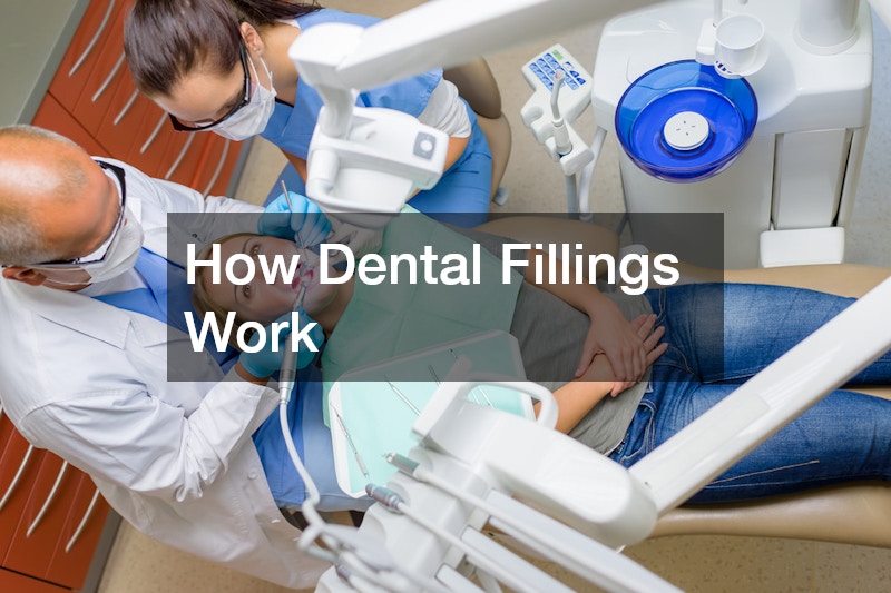 How Dental Fillings Work